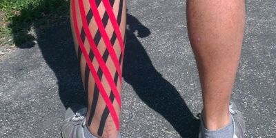 Kinesiotaping a Lymfotaping