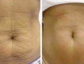 Kurz - Masáž Galvanic Spa Body - Bratislava
