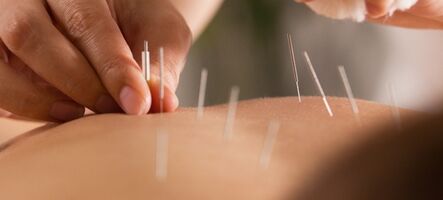 Masáž suchou ihlou
