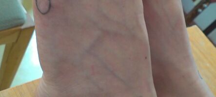 Reflexológia chodidiel III – lymfatický systém